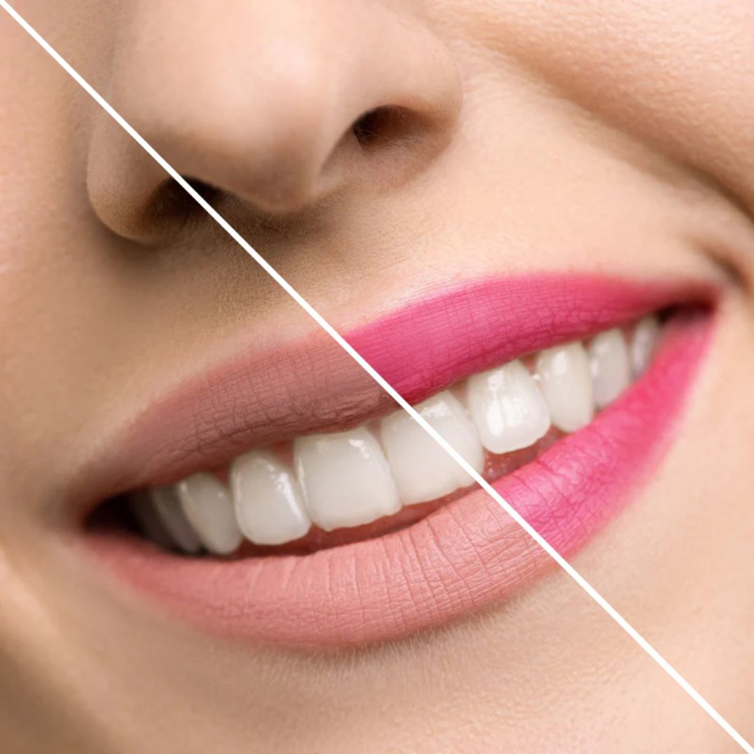 Shiny Lippenstift 'Blume in einer Box' zitrone/türkis